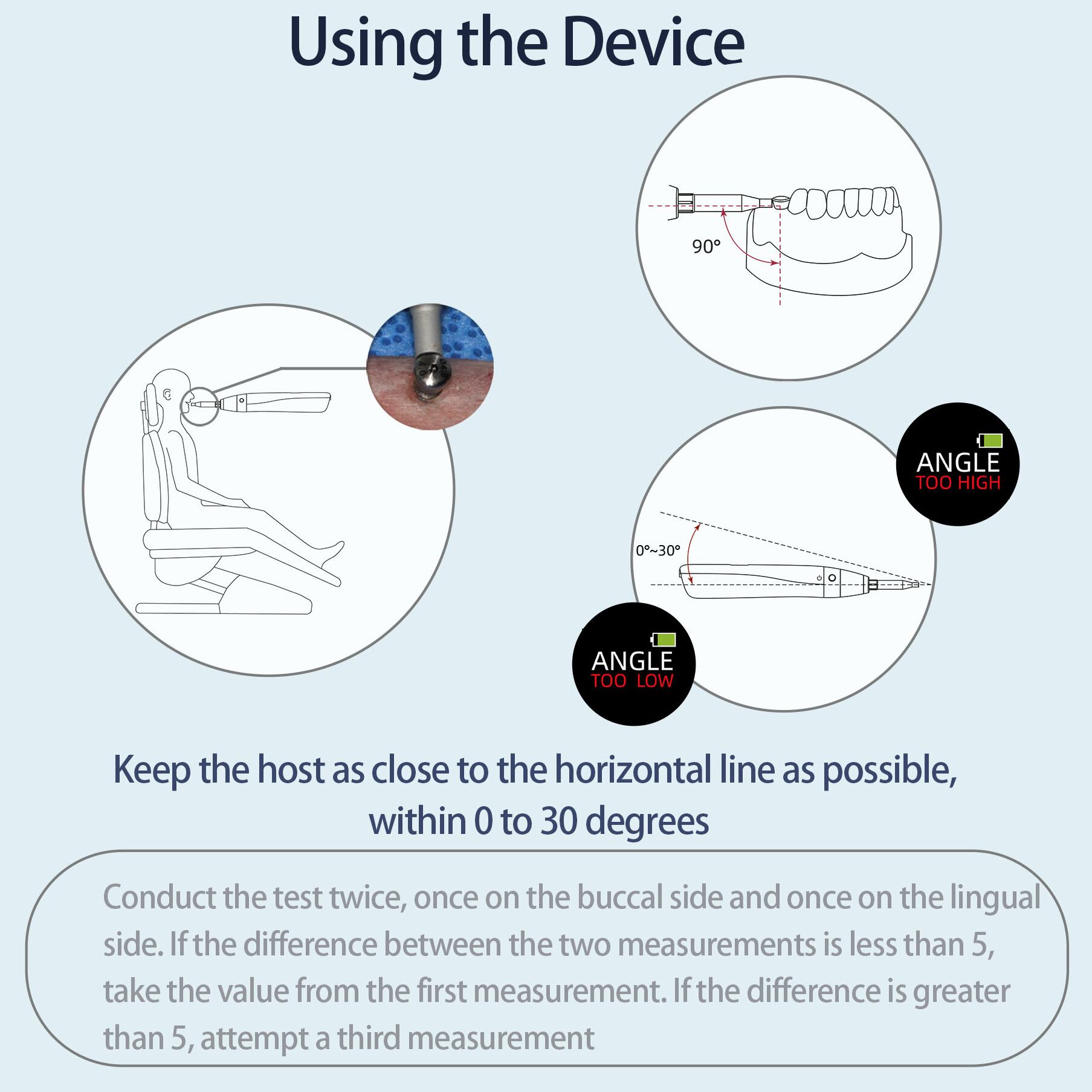 YAHOPE iCHECK Handheld Dental Implant Stability Meter Implant Stability Measurement ISQ Monitor 